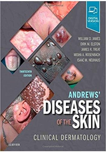 Andrews' Diseases of the Skin: Clinical Dermatology(نشر رویان پژوه)